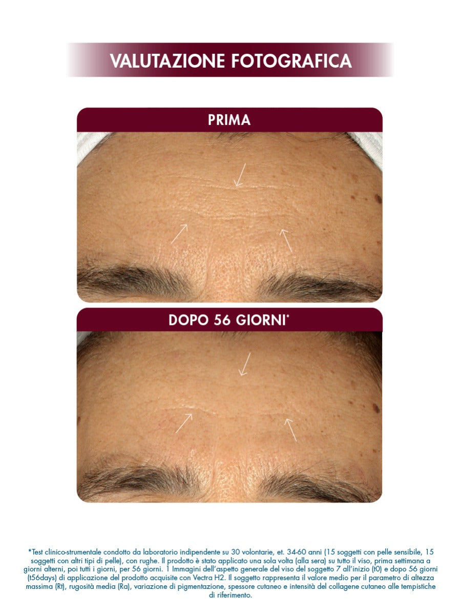 MIAMO TRI-RETINOID SURGE RESURFACING SERUM